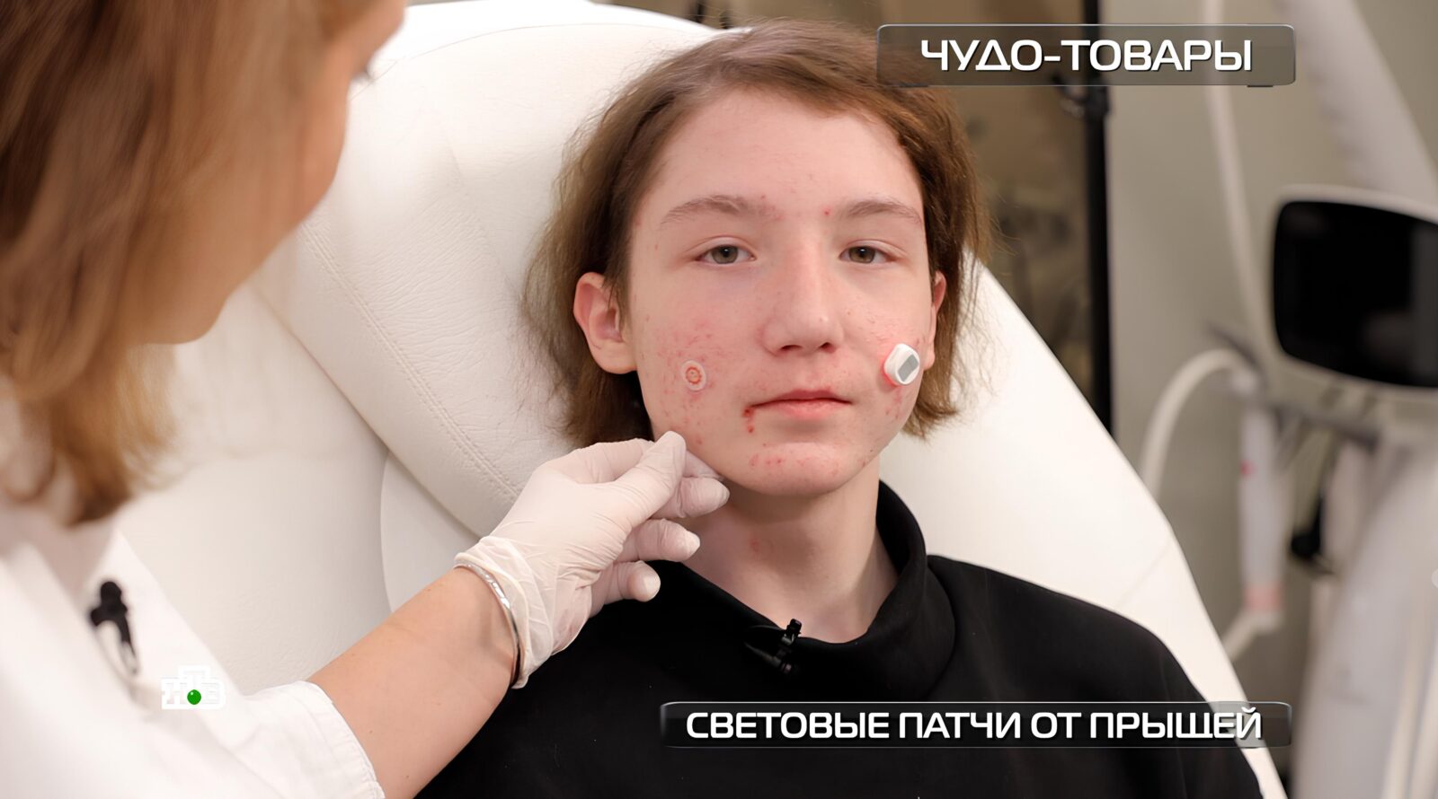 patchi-s-fonarikami-protiv-pryshhej