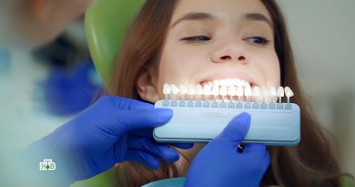 gollivudskaya-ulybka-svoimi-rukami Голливудская улыбка своими руками: проверка недорогих средств для отбеливания